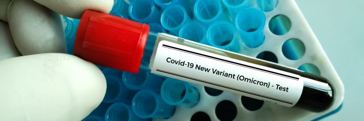 Covid-19, Omikron, nowy wariant, fot. Shutterstock